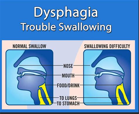 difficulty swallowing medical term